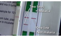 A Cheaper, Easier Way To Test For Malaria - Video