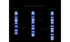 Copy Number Variants (CNV)