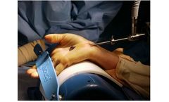 Carpal Tunnel for Endoscopic Surgery