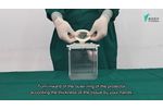 The operating steps of single use wound protector - Video