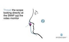 SNAP, Endoscope Guide Assembly Steps for Clinicians - Video