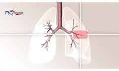 Wirkprinzip Atemtherapiegerät RC-Cornet PLUS - löst Schleim, reduziert Husten und lindert Atemnot - Video