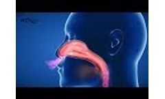 Atemtherapiegerät RC-Cornet PLUS NASAL - Wirkprinzip 3D-Animation - freie Nase ohne Medikamente - Video
