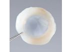 OptiGraft - Model V01013/V0106 - Sterile Cornea Graft