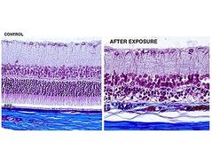 Figure 2: Effect of blue light on retina cells.