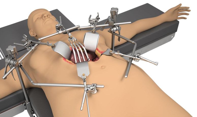 Thompson - Bariatric System