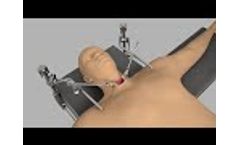 Set Up: Head & Neck Retractor System (Thyroid/Carotid) - Video