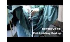 Laparoscopy Assistant - SurgiAssist Uterine Positioner - Video