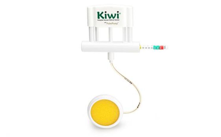 Kiwi - Model OmniCup - Complete Vacuum Delivery System