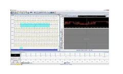 HolterSoft Ultima - Software for Holter and ABPM