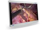 Radiance - Model Ultra 32 Inch - Premium Endoscopy Visualization Display