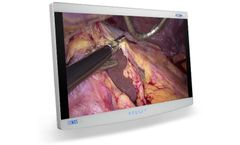 Radiance - Model Ultra 32 Inch - Premium Endoscopy Visualization Display