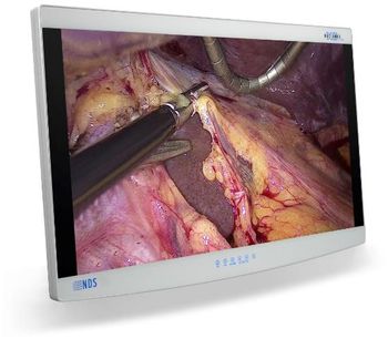 Radiance - Model Ultra 32 Inch - Premium Endoscopy Visualization Display