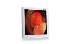 EndoVue - Model 19 Inch - Value Endoscopy Visualization