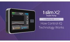 How Control-IQ Technology Works on the t:slim X2 Insulin Pump - Video