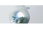 Aurora - Model 1.5T - Breast MRI System