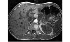 Orviglance - MR-Imaging of the Liver