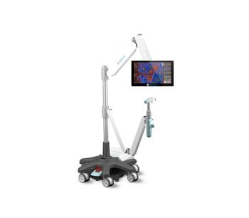 DYSISmap - Clinically-proven Digital Colposcope Software