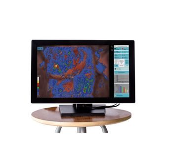 DYSIS View - Colposcope Software