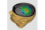 NBT - Navigated Brain Therapy System for Alleviating Chronic Neuropathic Pain Relief - Medical / Health Care - Clinical Services