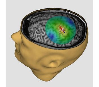 NBT - Navigated Brain Therapy System for Alleviating Chronic Neuropathic Pain Relief - Medical / Health Care - Clinical Services