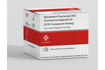 Sansure - Mycoplasma Pneumoniae DNA Fluorescence Diagnostic Kit (PCR-Fluorescence Probing)