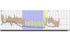 Meditech - Version CardioVisions - Holter Management Software