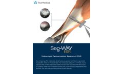 Seg-Way - Model EGR - Endoscopic Gastrocnemius Recession System - Brochure