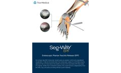 Seg-Way - Model EPF - Endoscopic Plantar Fasciitis System  - Brochure