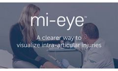 mi eye 2 | In-Office Knee Arthroscopy - Dr. John Xerogeanes - Video
