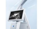 Zeiss Infrared - Model 800 - Fluorescence-Based Video Angiography