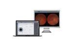 Zeiss - Data Management Scalable Ophthalmology Software