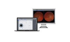 Zeiss - Data Management Scalable Ophthalmology Software