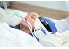 Ventilator-Associated Pneumonia (VAP)