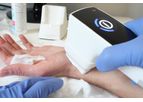 Plasma Derma Care - Hightech Handheld for the Treatment of Skin Diseases - Mobile