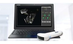 Pathway - Ultrasound Imaging System for Lumbopelvic Rehabilitation