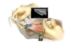 Orthocell - Model Ortho-ATI - Autologous Tenocyte Implantation