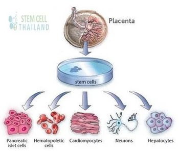 Placenta, Amniotic Membrane & Chorion Derived Stem Cells