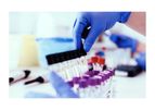 PAVmed EsoGuard - Esophageal DNA Test Kit