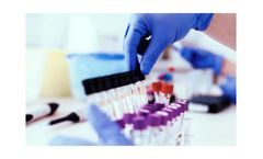PAVmed EsoGuard - Esophageal DNA Test Kit
