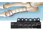 i2b 5MS - Lateral Neck Plate