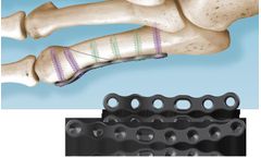 i2b 5MS - Lateral Neck Plate