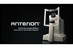 ANTERION – Multimodal Imaging Platform Optimized for the Anterior Segment - Video