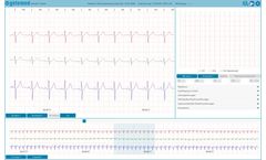GETEMED - Version HeartX Viewer - Web-based ECG Viewer for Telemedical ECG Reporting