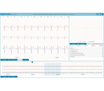 GETEMED - Version HeartX Viewer - Web-based ECG Viewer for Telemedical ECG Reporting
