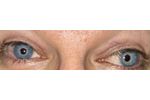 Artificialiris Medical Device for Patient - Medical / Health Care - Clinical Services