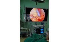 SHREK - Model BT550S - 4K UHD Medical Endoscope Monitor 55 Inch