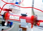 Invizius H-Guard - Ultra-high Hemocompatibility for Dialysis and other Extra-corporeal Circuits