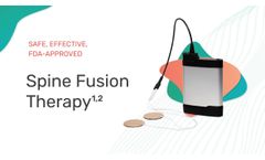 ActaStim-S Spine Fusion Stimulator Patient Quick Start Guide- Video