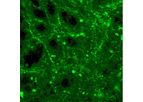 Cerevast - Transcranial Ultrasound Neuromodulation